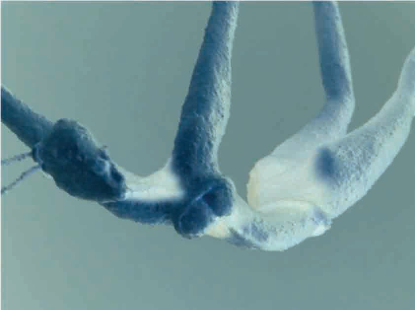 Trapeze Artist series